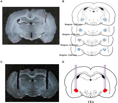 Exogenous Orexin-A Microinjected Into Central Nucleus of the Amygdala Modulates Feeding and Gastric Motility in Rats